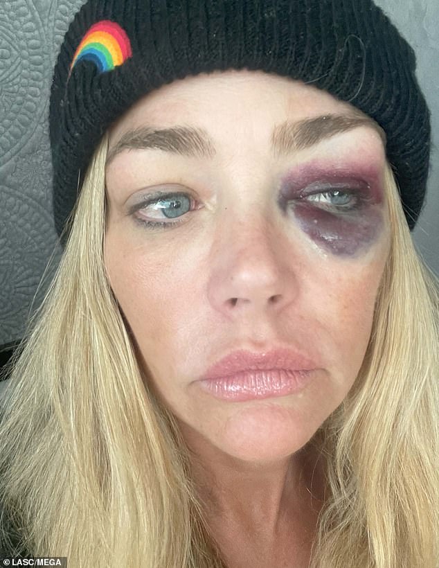 According to court documents obtained by People, Richards alleged that Phypers would 'frequently violently choke' her, squeeze her head with his hands, tightly grip her arms, slap her face, slam her head into a bathroom towel rack, and 'threaten to kill' her