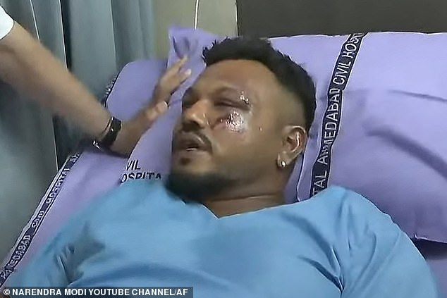 Pictured: Vishwash Kumar Ramesh, the sole survivor of the Air India flight 171 crash