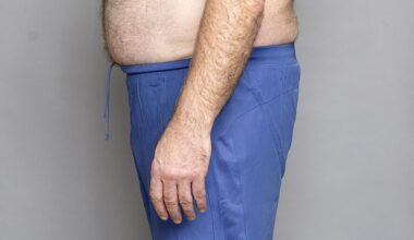 Donal Macintyre before starting his diet, at 17st 7lb