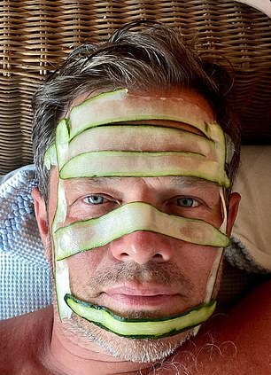 Model Paul Sculfor swaddled himself in cucumber ribbons after a little too much sun