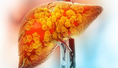 The 36-year-old shared which foods she's cutting out from her diet to reverse her NAFLD