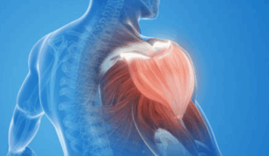 Top 5 foods for muscle recovery