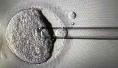 Eight babies born from pioneering IVF technique to prevent devastating disease