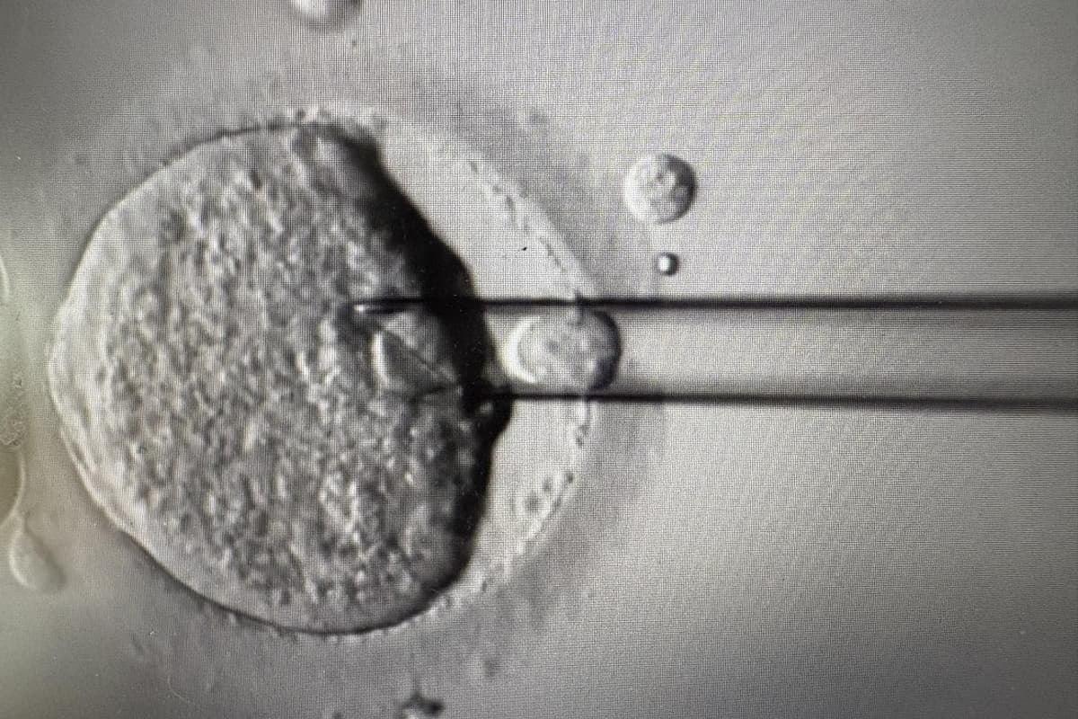 Eight babies born from pioneering IVF technique to prevent devastating disease
