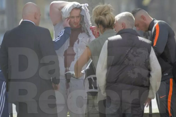  Drugs baron Sean 'Lugs' McGovern moments after he was attacked by Togher 