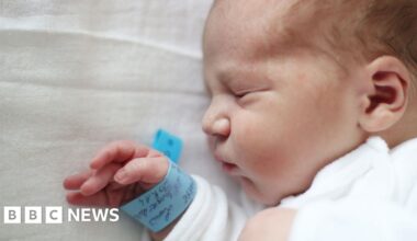 RSV vaccine to be offered to premature babies in Northern Ireland