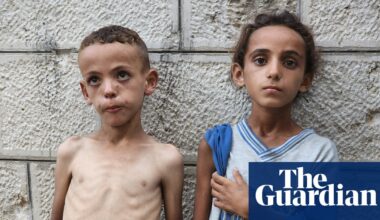 ‘We faced hunger before, but never like this’: skeletal children fill hospital wards as starvation grips Gaza | Gaza