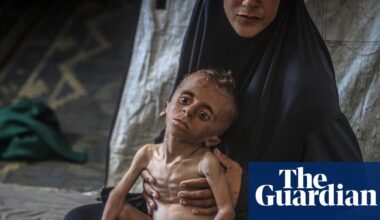 Severe malnutrition in under-5s has tripled at Gaza City clinic, charity reports | Gaza