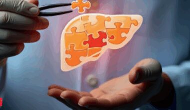 Non-alcoholic fatty liver disease: An acute menace and a silent killer