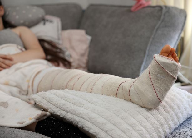 Lexi's injured leg after being hit by a car outside Waterhead Academy