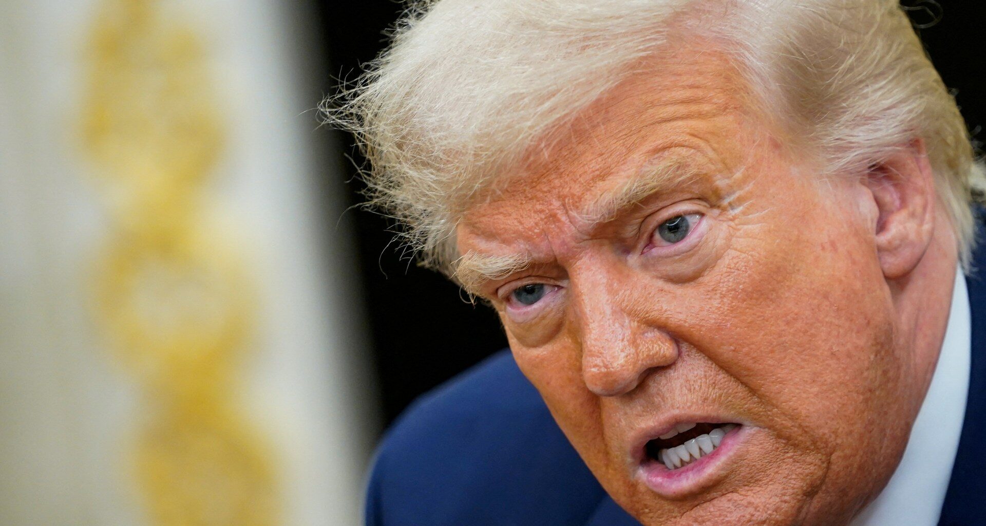 Trump diagnosed with ‘chronic venous insufficiency’ after leg swelling | Donald Trump News