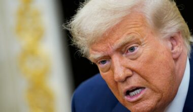 Trump diagnosed with ‘chronic venous insufficiency’ after leg swelling | Donald Trump News