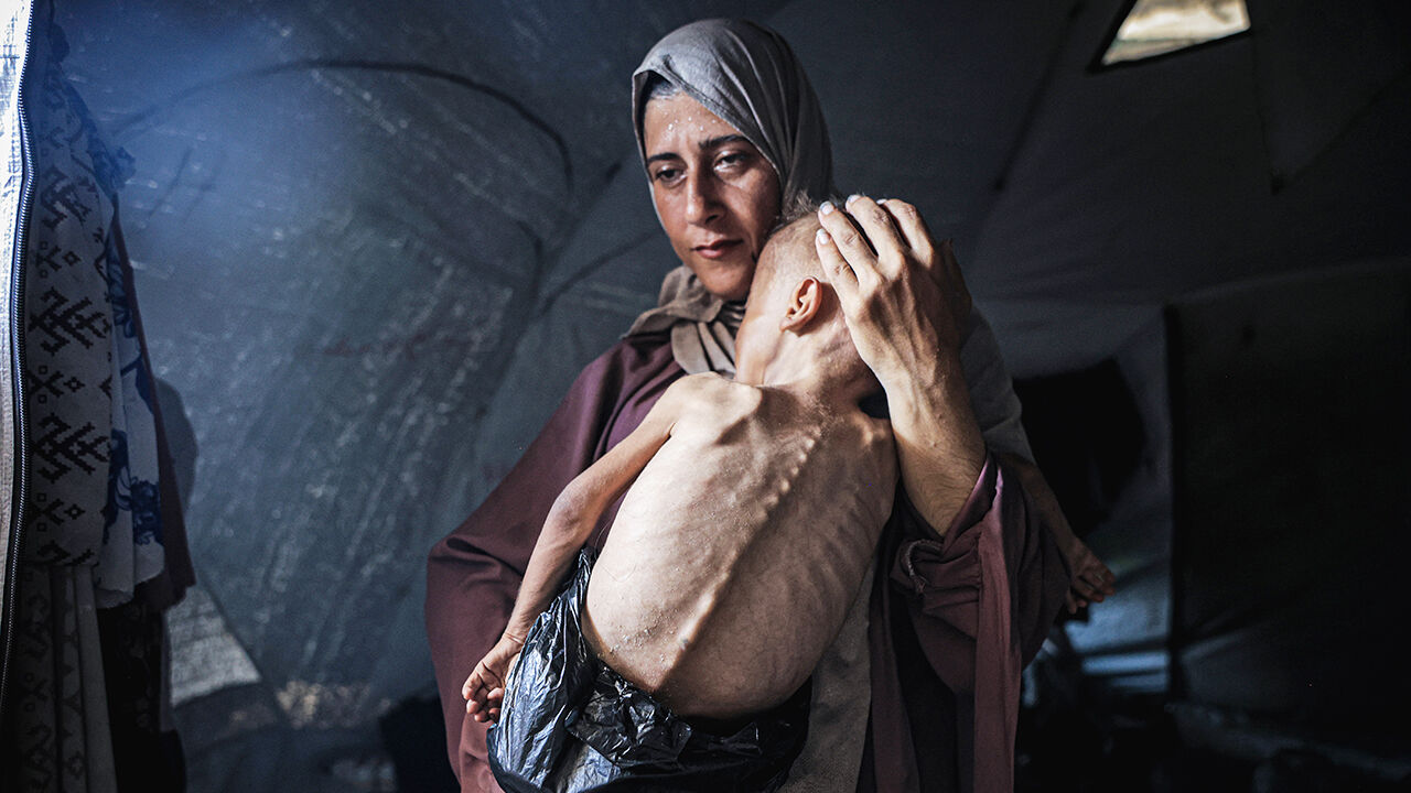A mother holds her malnourished toddler in Gaza