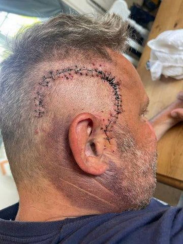 Andy Hampton died after a brain tumour left him convinced his wife was having an affair