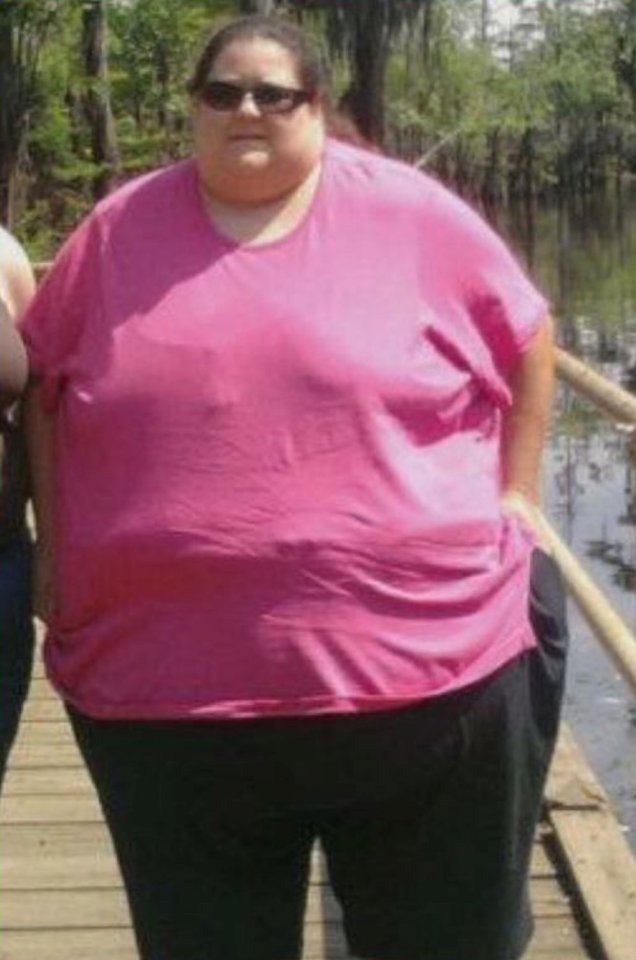 Woman in pink shirt and black pants before weight loss.