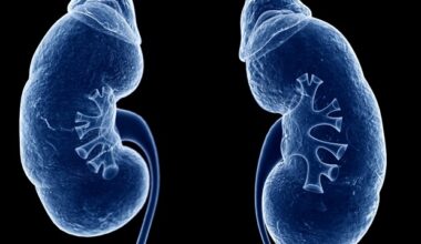 New genetic marker improves kidney transplant match predictions