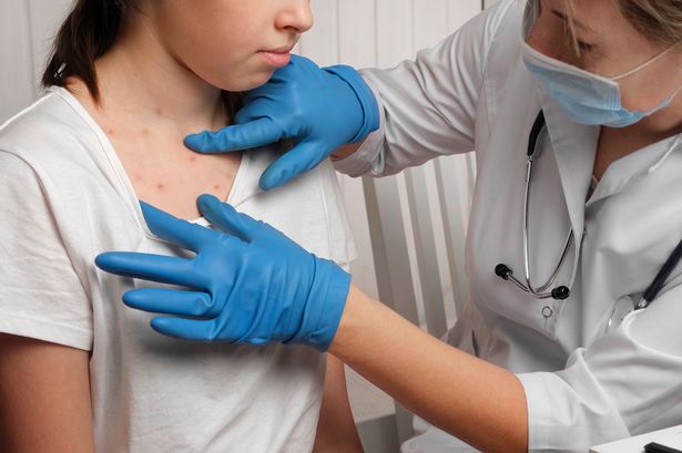 The World Health Organisation says a threshold of 95 per cent is needed to achieve herd immunity.