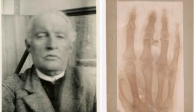 Blood, skeletons and syphilis: the story of Edvard Munch’s obsession with health - The Art Newspaper