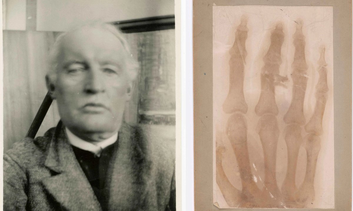 Blood, skeletons and syphilis: the story of Edvard Munch’s obsession with health - The Art Newspaper