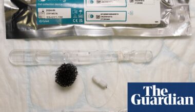 NHS pharmacies to pilot ‘sponge on a string’ test to spot cancer precursor | NHS