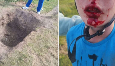Cycling track sabotaged in Peel, injuring boy