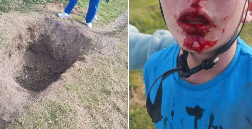Cycling track sabotaged in Peel, injuring boy
