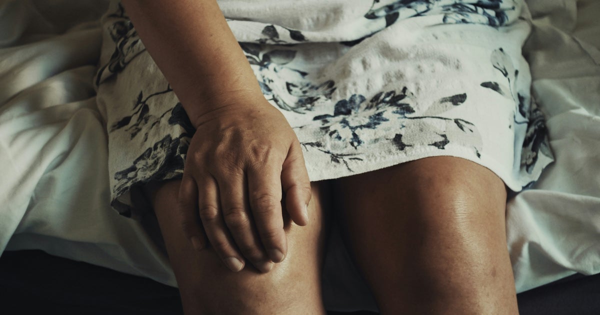 The 5 Best Pilates Exercises To Strengthen A 'Runner's Knee'