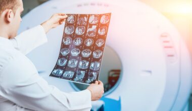 Revvity Slashes Outlook As China Policy Deals Diagnostics Blow