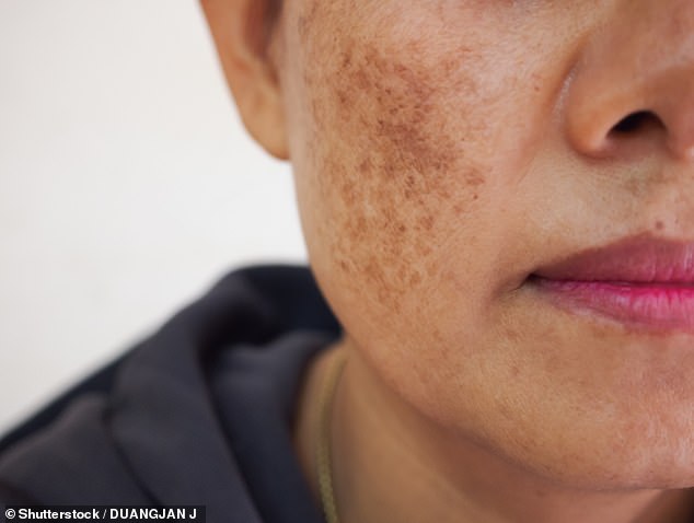 According to experts at the clinic, fine lines and wrinkles, hyperpigmentation, sunspots and an uneven skin tone are all tell-tale signs of skin damage