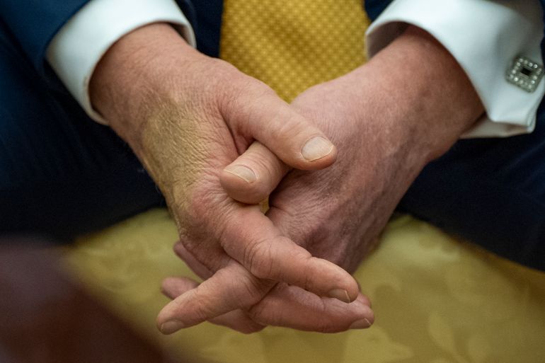 Trump hands