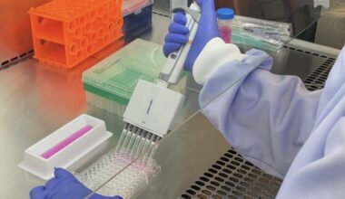 Chronic UTI patients could finally see new treatment on NHS