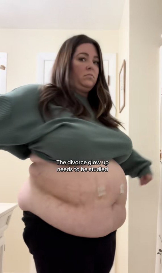 I lost 5 stone on fat jabs & now look unrecognisable - I get hate & called an 'Ozempic cheat' but they're just jealous, https://www.tiktok.com/@loseitwithliv/video/7526299301933354270?