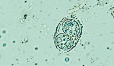 This parasite can alter your behavior, and 2 billion humans already have it