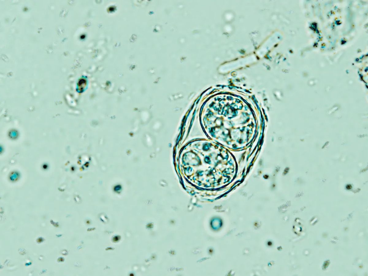 This parasite can alter your behavior, and 2 billion humans already have it