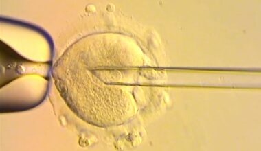 Healthy babies born in Britain after scientists used DNA from three people to avoid genetic disease