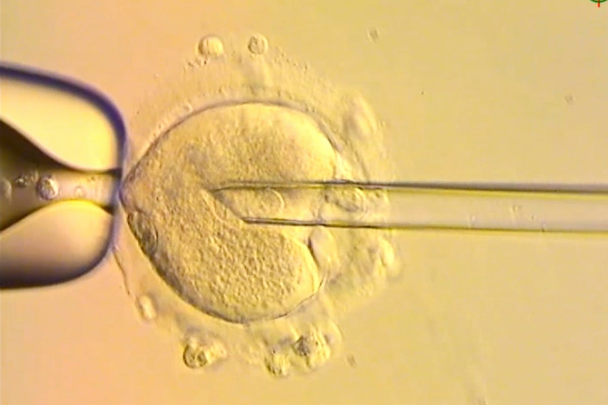 Healthy babies born in Britain after scientists used DNA from three people to avoid genetic disease