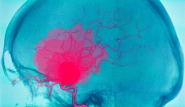 Exploring the genetic link between COPD and abdominal aortic aneurysm