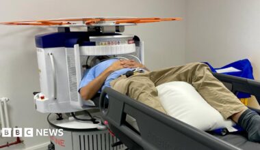 A man lying on his back on a medical trolley with his head inside a scanner