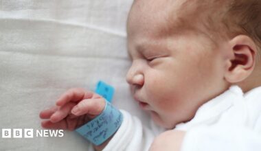 A baby boy is sleeping on a white sheet. He is wearing a white sleepsuit and has a blue hospital wristband