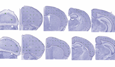 Genetic testing; LSD1 inhibitors; and more