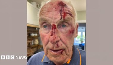 A picture of Roger Dunn. He has several injuries to his face, with blood coming out of wounds to his nose and forehead, and further cuts around his mouth