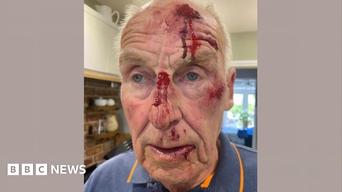 A picture of Roger Dunn. He has several injuries to his face, with blood coming out of wounds to his nose and forehead, and further cuts around his mouth