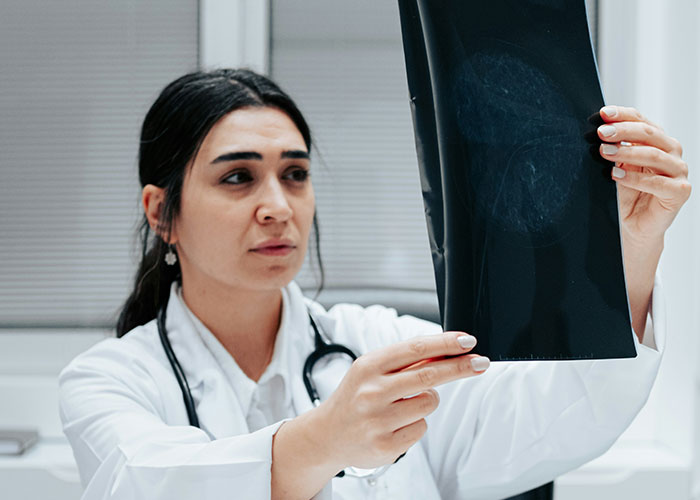 Female doctor examining an X-ray, highlighting the consequences of patients delaying medical help and treatment.