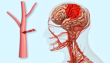 Anticoagulants in AF Post-ICH: The Dilemma Continues