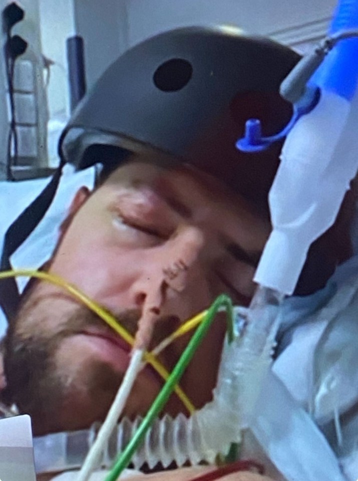 A man in a hospital bed wearing a protective helmet, connected to medical equipment.