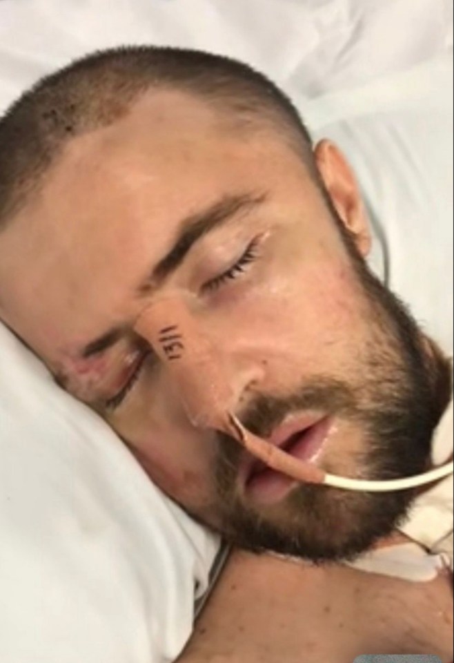 Man in hospital bed with facial injuries.