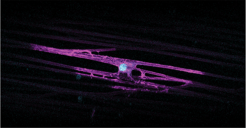 Researchers identify gene implicated in disorders affecting millions