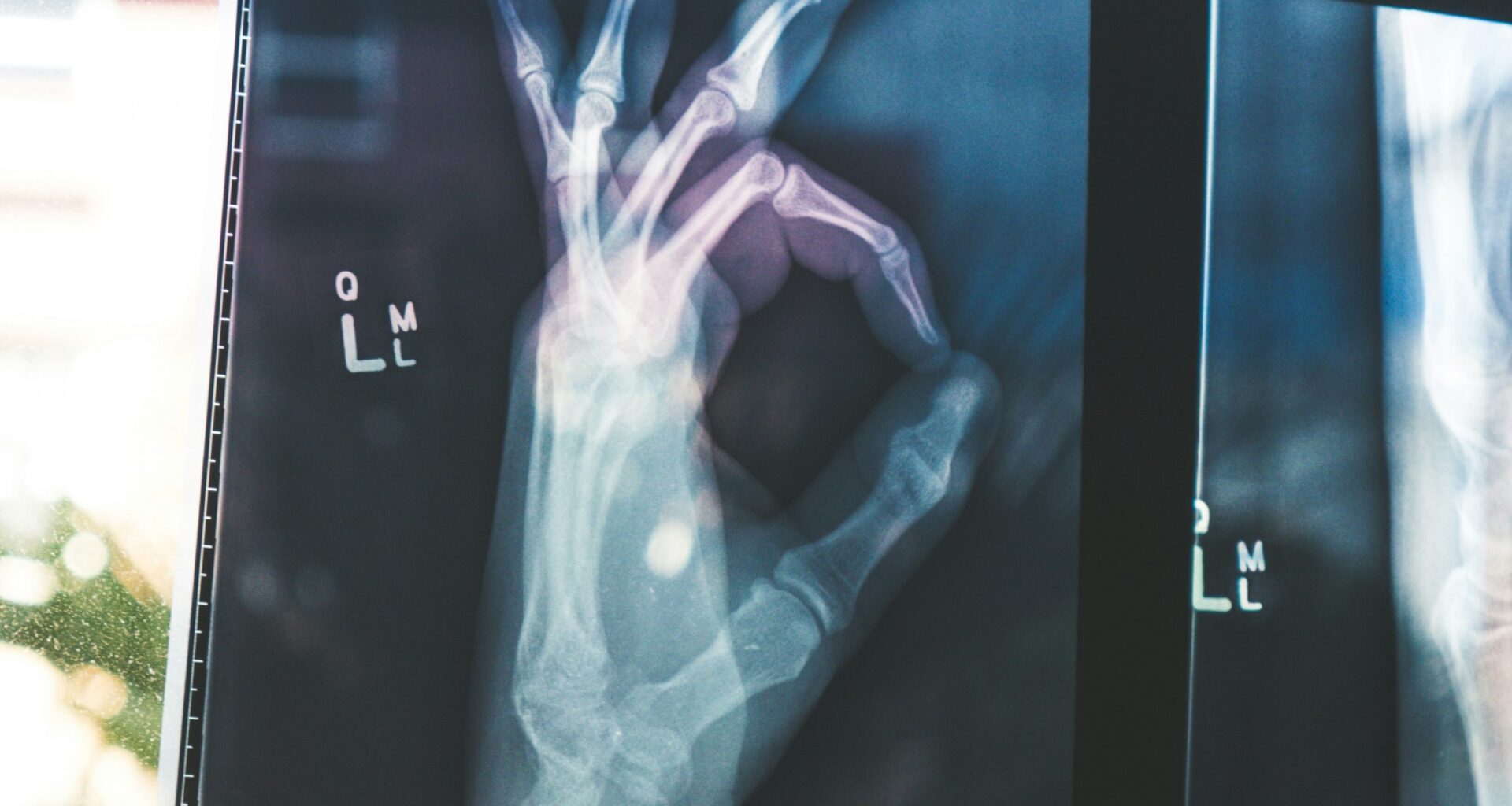 Google's open MedGemma AI models could transform healthcare