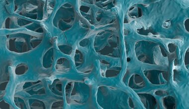 Does Romosozumab Deserve Its Black Box Warning?