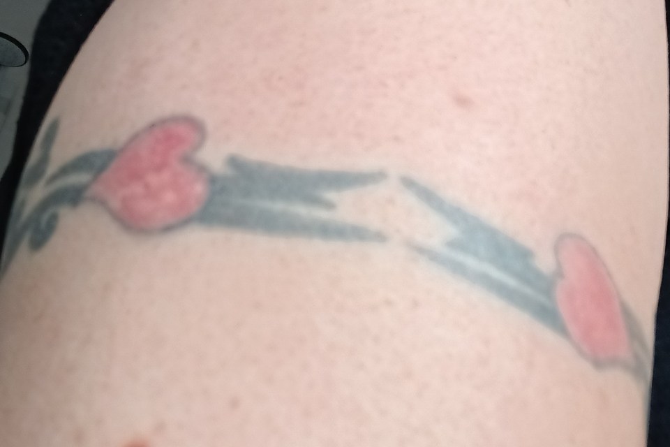 Close-up of a faded arm tattoo of hearts and a stylized design.